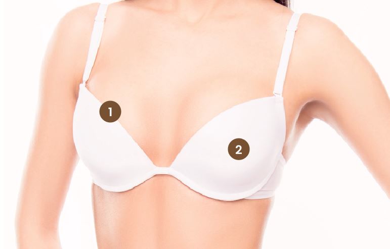 breast plastic surgery in Ipoh and Manjung, Perak